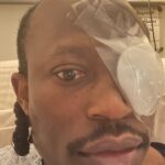 Limerick entrepreneur loses sight in one eye following an attack